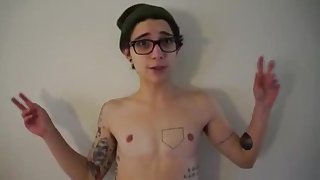 3 Years Post-op - Show and Tell