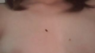 how much birthmark, please count it