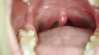Asian girl's uvula 4