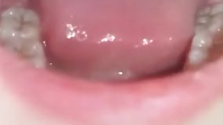 girl uvula2